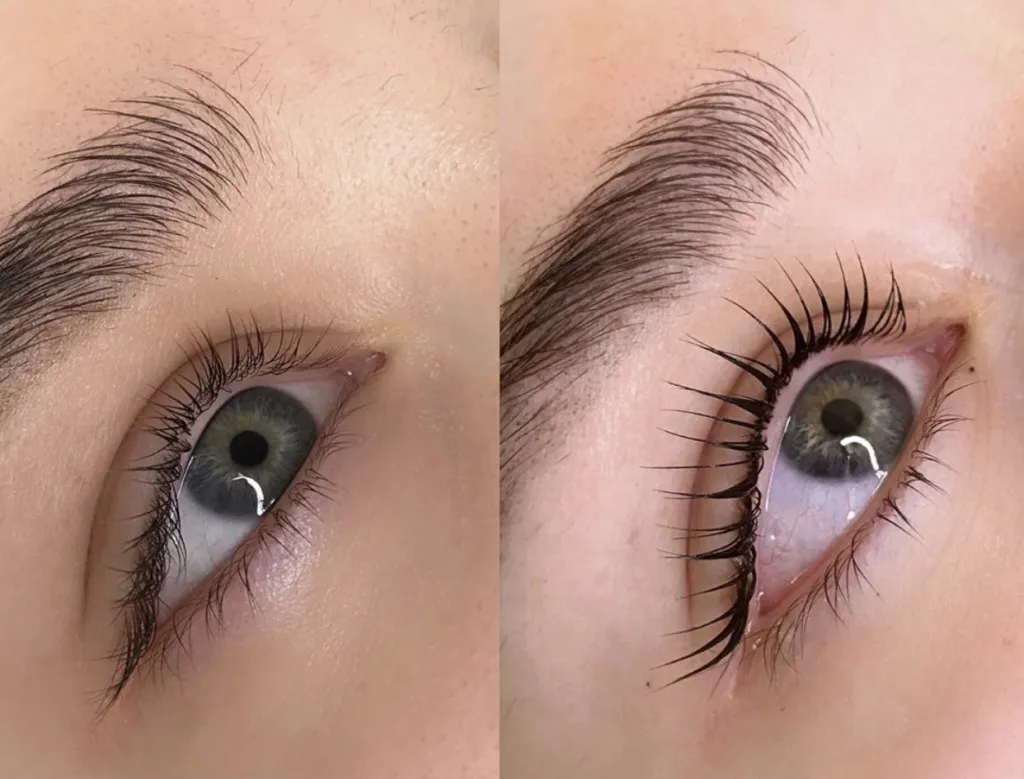 Ламинирование ресниц или ботокс?